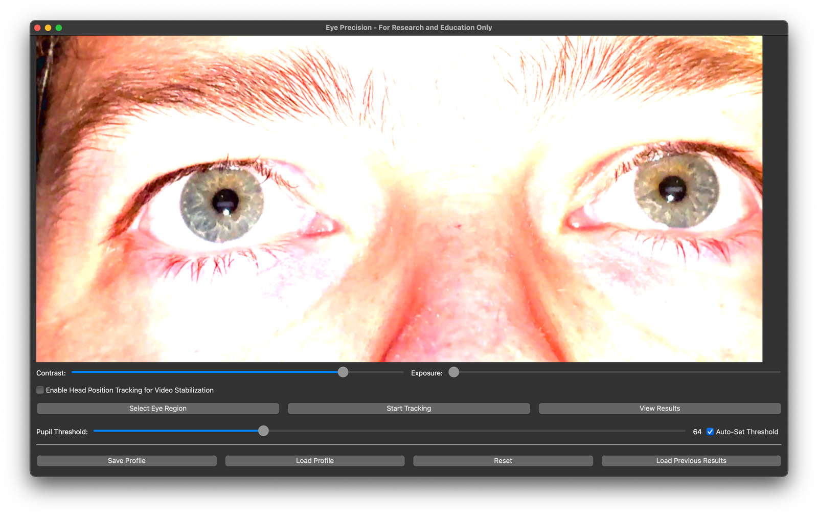 Video with settings in app