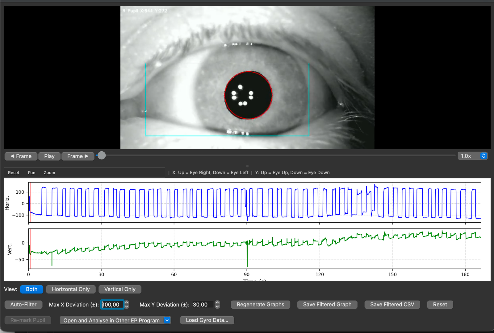 Eye Precision Open In Menu