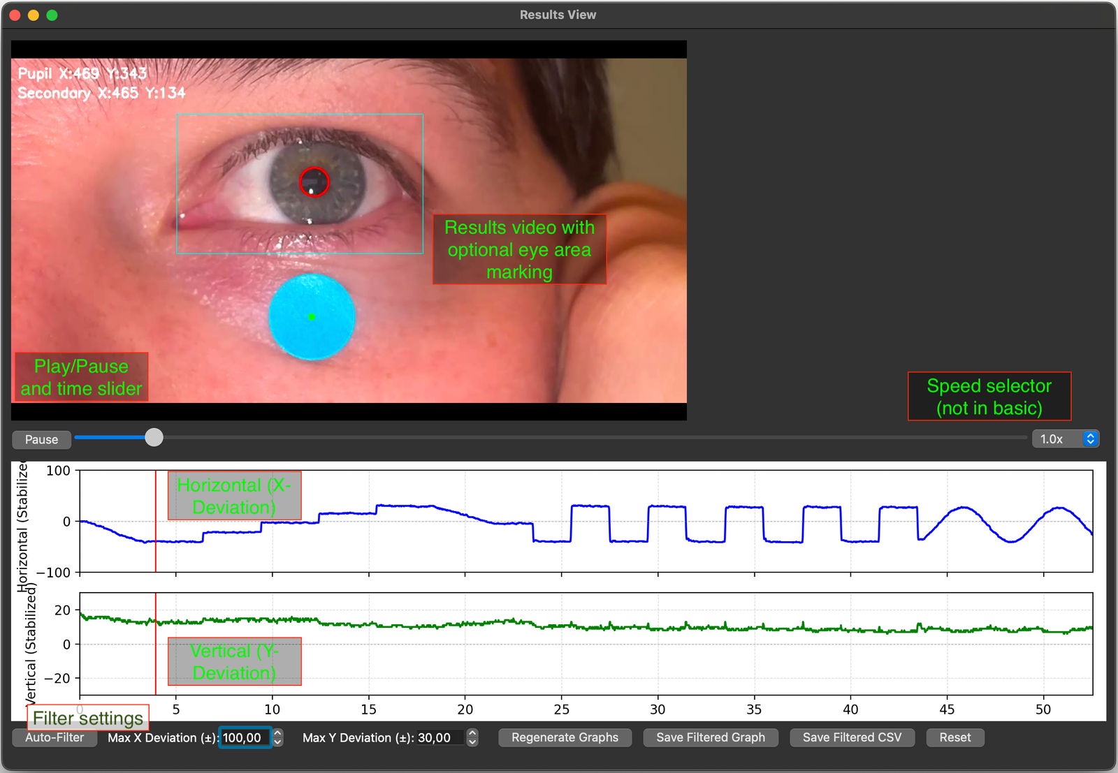 Results view in Eye Precision