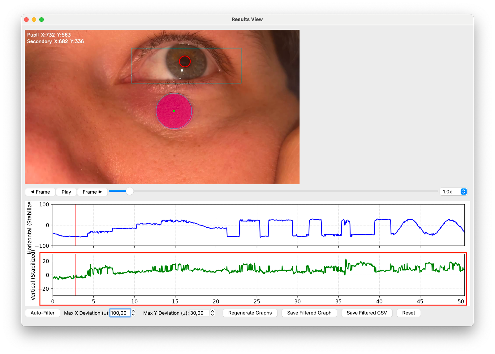 Vertical eye movement graph