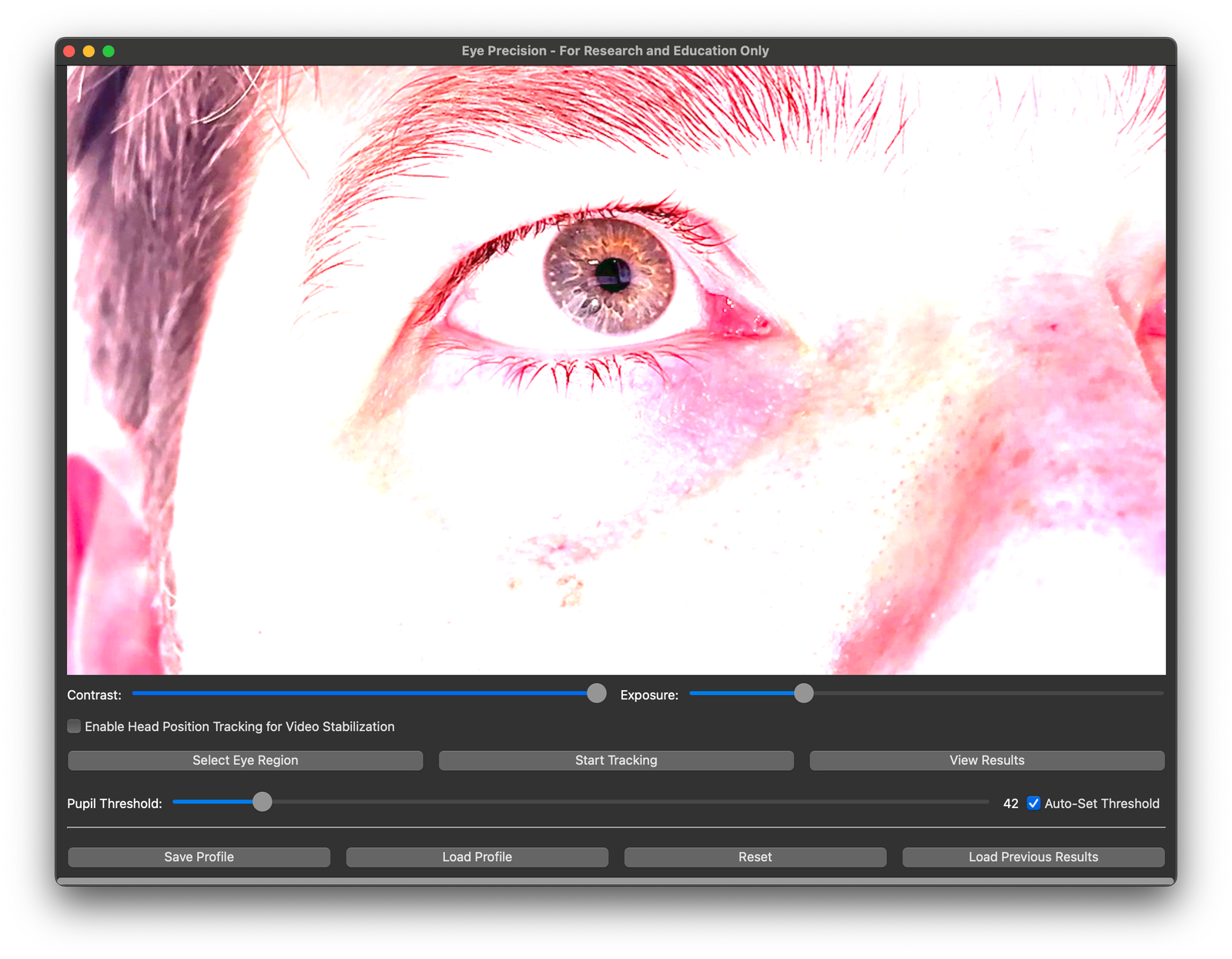 Video with settings in app